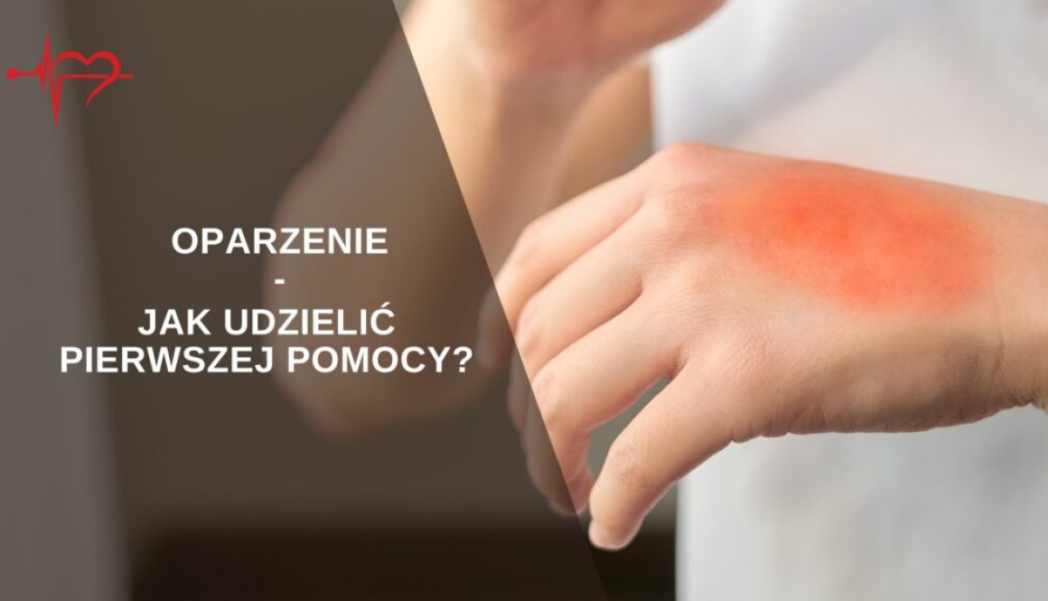 oparzenia- pierwsza pomoc