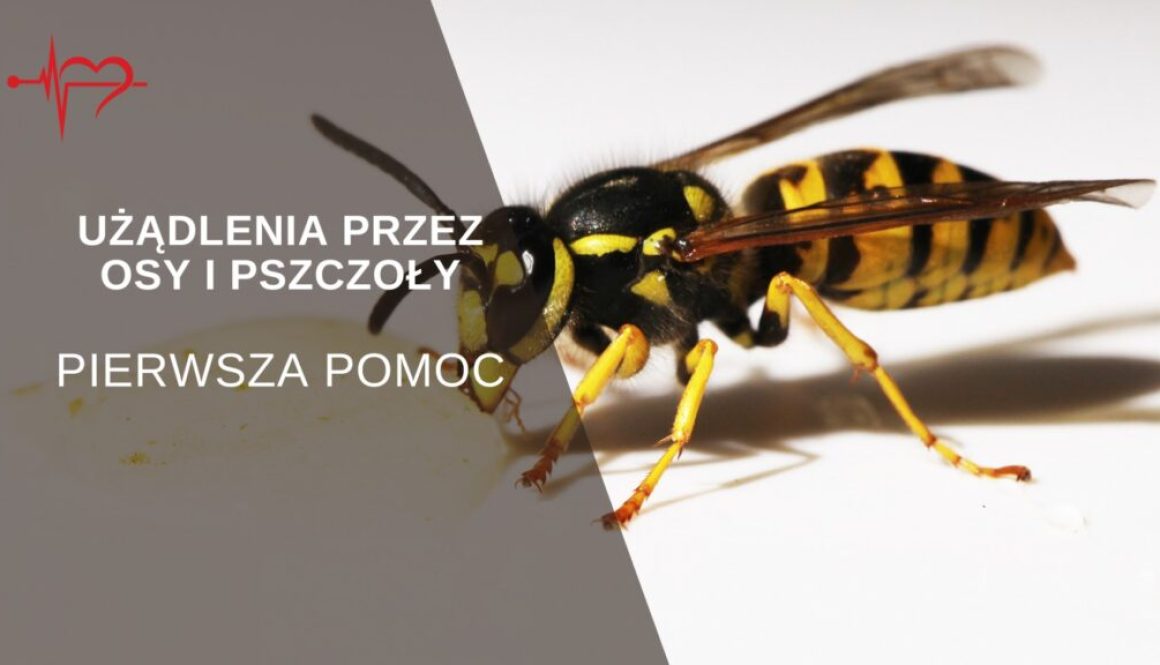 uzadlenie-przez-osy-i-pszczoly