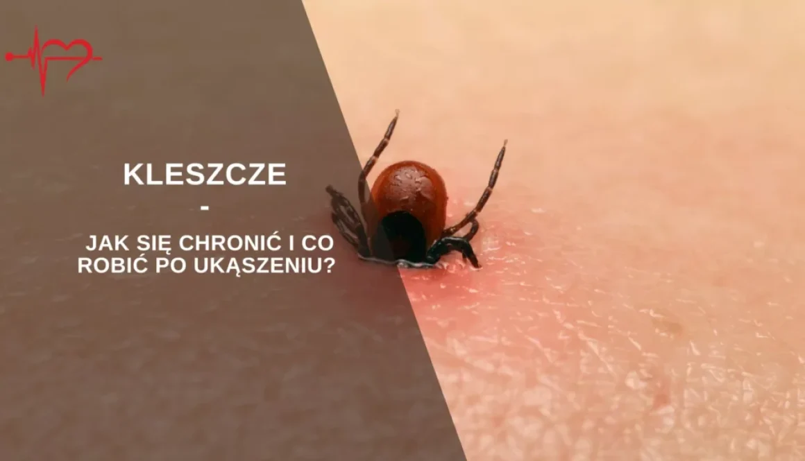 kleszcze-.jpg