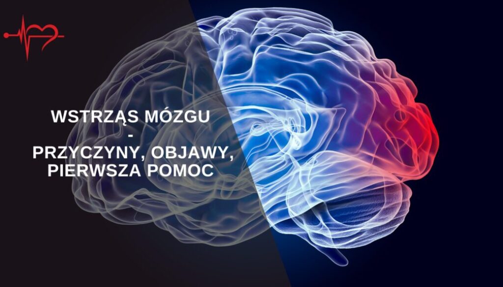 wstrzas-mozgu-1024x576-1